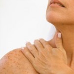 Sun-Damaged Skin? Consider Fraxel