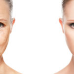 Fraxel Laser Treatment Reverses the Effects of Aging on the Face