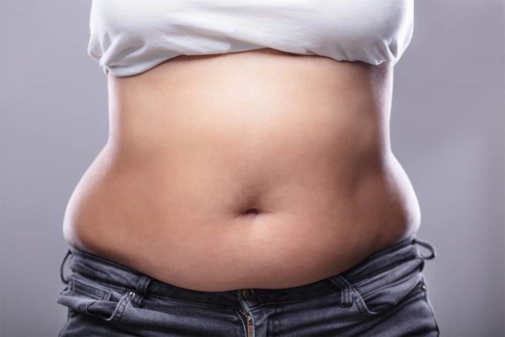 Coolsculpting Will Flatten Your Tummy Without Surgery