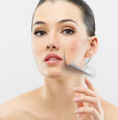 treat acne scars