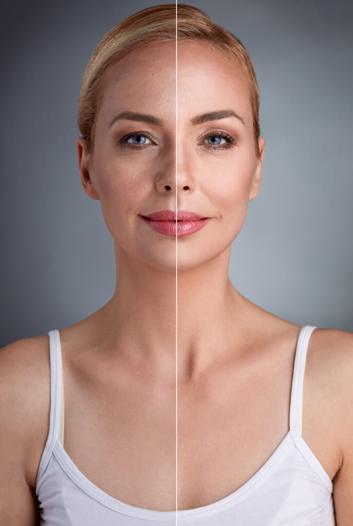 beauty concept, before and after