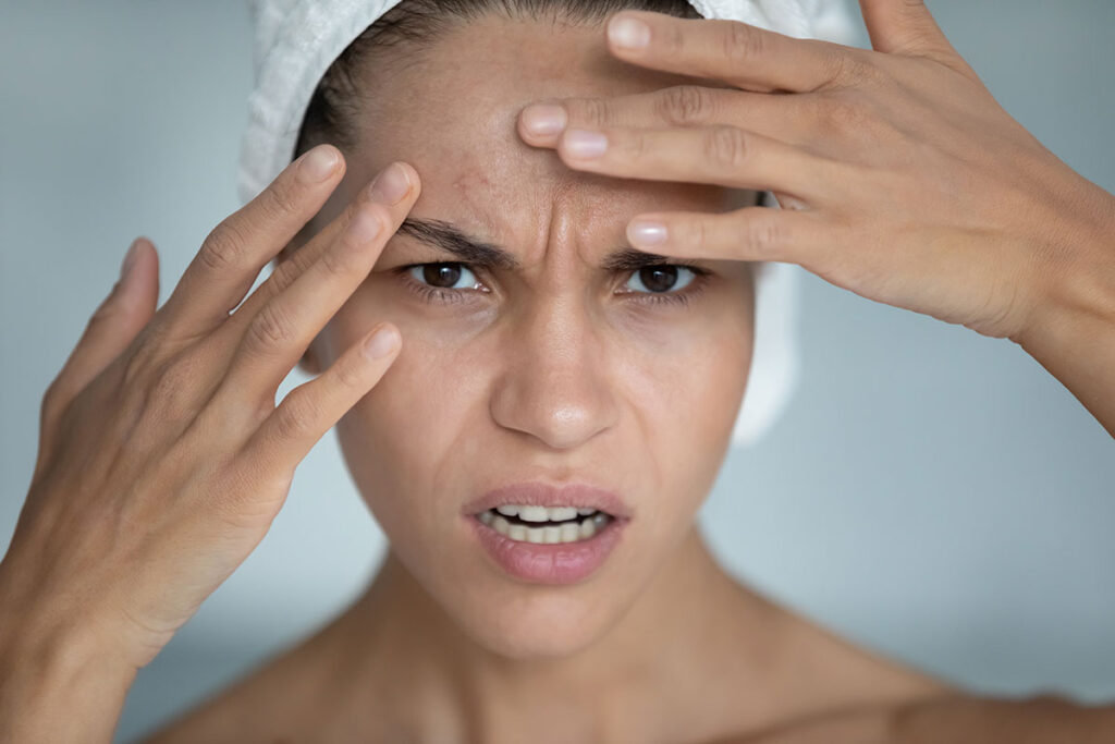 Woman touching her face in relation to a bad experience with Botox.