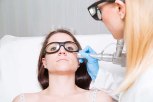 Removing mole with medical laser