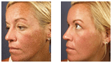 Before and After Skin Care Services in Houston, TX