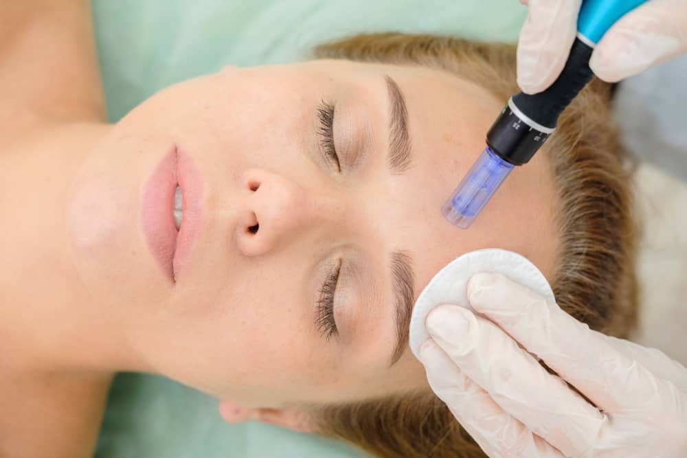 Microneedling is an extremely versatile procedure.
