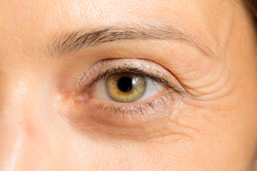 Some people start to notice sagging in their brows first, while others begin to look tired and thin due to volume loss.