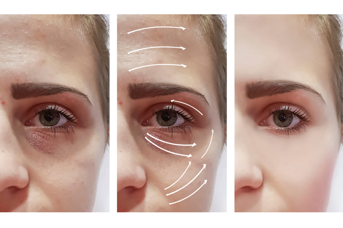 3 Ways Botox Can Rejuvenate Your Face Above the Mask Houston, TX