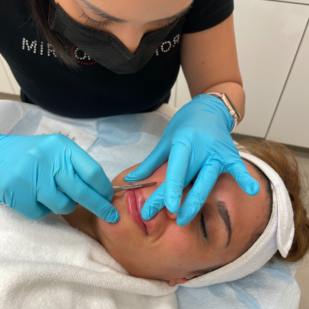 Our expert aestheticians physically exfoliate your skin with a sterile surgical blade to gently shave the top layer of skin.