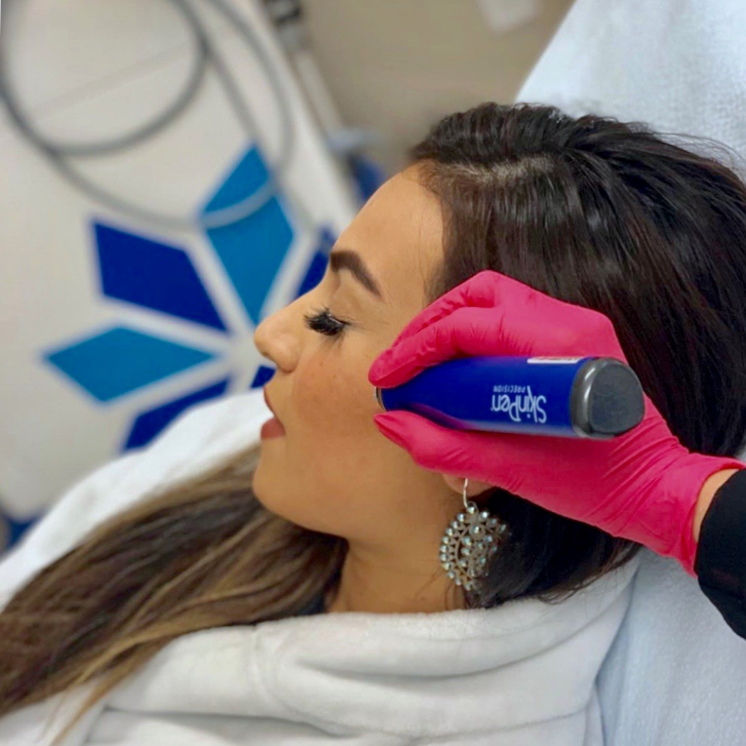 The SkinPen is part of the microneedling process