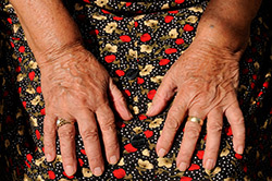 How To Fade Age Spots