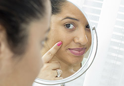 Ways to Cope With Acne