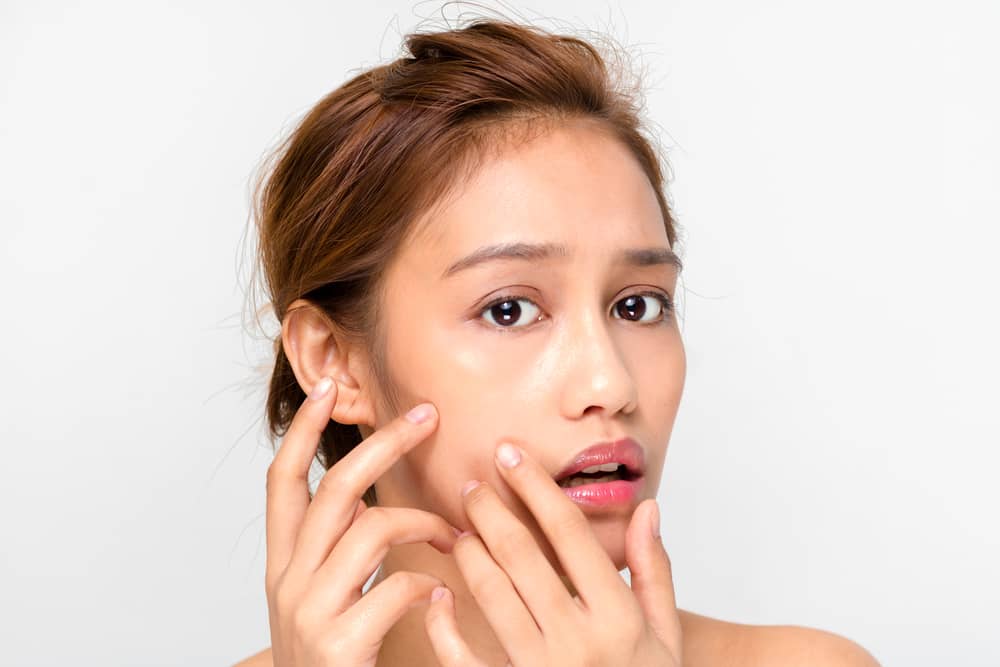 There’s no cure for acne, but it is possible to manage and treat it. The first step is to identify what’s causing the breakouts in the first place.