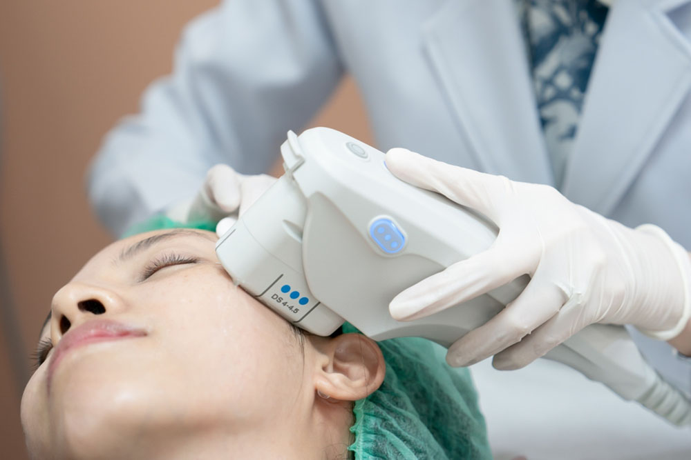 The results of Ultherapy Lift Treatment are visible almost immediately after the procedure, with optimal results appearing gradually over 2-3 months.