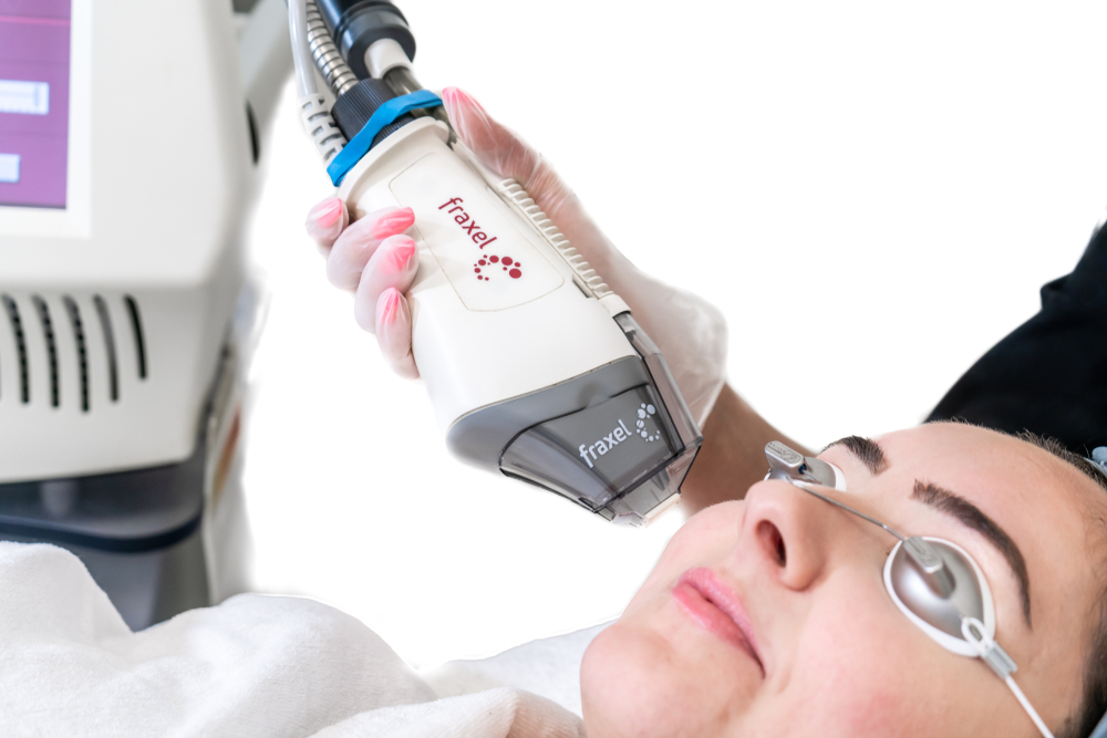 Fraxel Laser promotes growth of new, healthy skin.