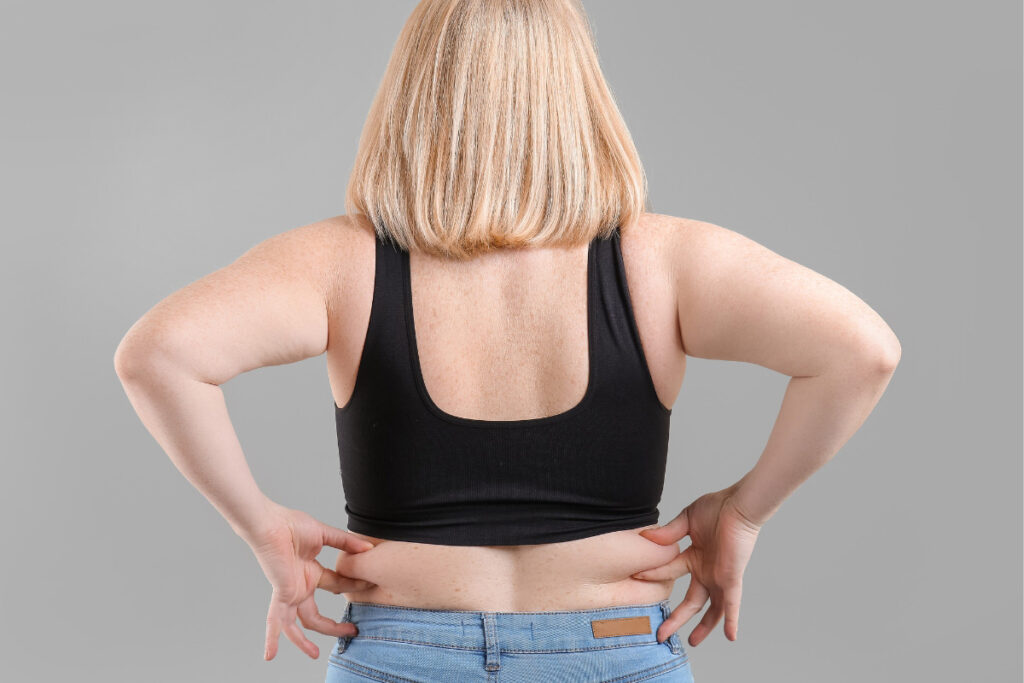 Person's back view showing skin marked for precise CoolSculpting.