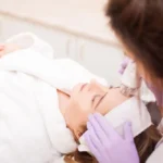 Exploring Ultherapy Brow Lift: Procedure Insights and Patient Experiences