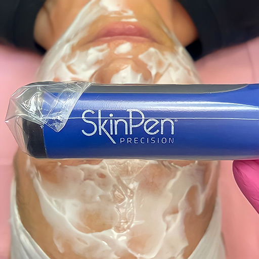 Mirror Mirror Beauty Boutique performs its medical microneedling treatments using the SkinPen®️️