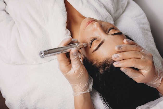 Microneedling procedure on woman's face focusing on safety and side effects management.